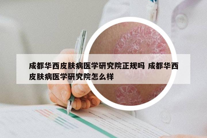 成都华西皮肤病医学研究院正规吗 成都华西皮肤病医学研究院怎么样