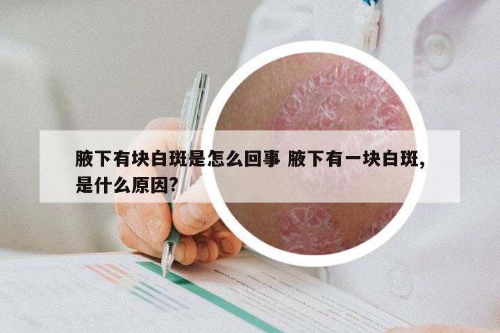 腋下有块白斑是怎么回事 腋下有一块白斑,是什么原因?