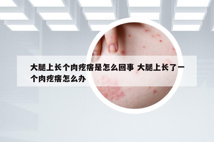 大腿上长个肉疙瘩是怎么回事 大腿上长了一个肉疙瘩怎么办