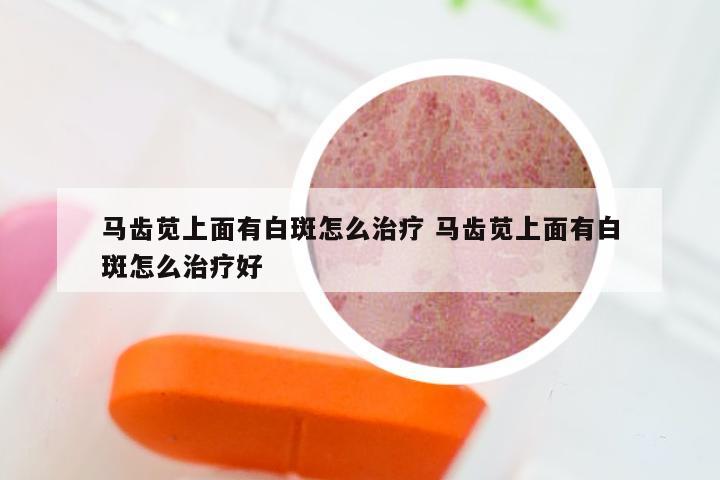 马齿苋上面有白斑怎么治疗 马齿苋上面有白斑怎么治疗好