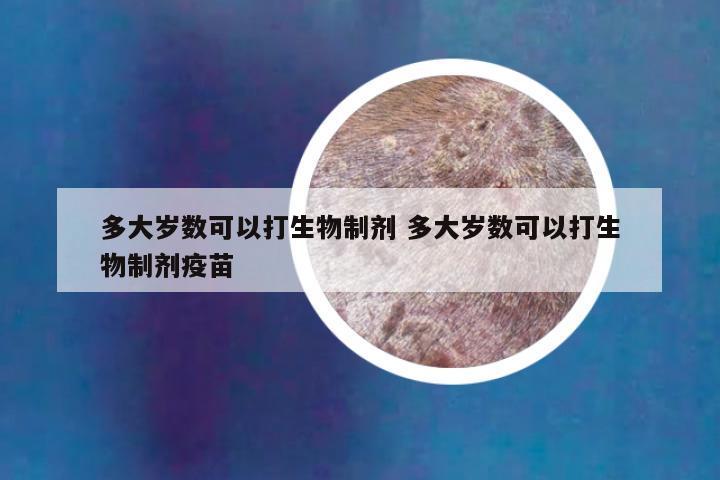 多大岁数可以打生物制剂 多大岁数可以打生物制剂疫苗