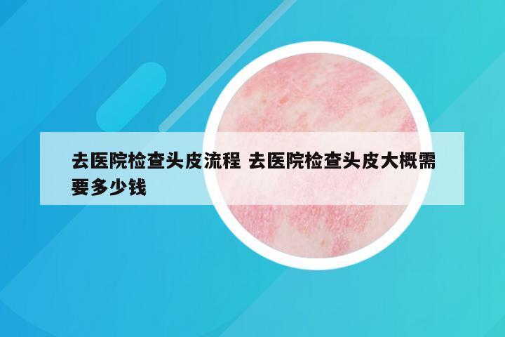 去医院检查头皮流程 去医院检查头皮大概需要多少钱