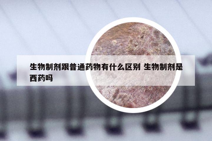 生物制剂跟普通药物有什么区别 生物制剂是西药吗