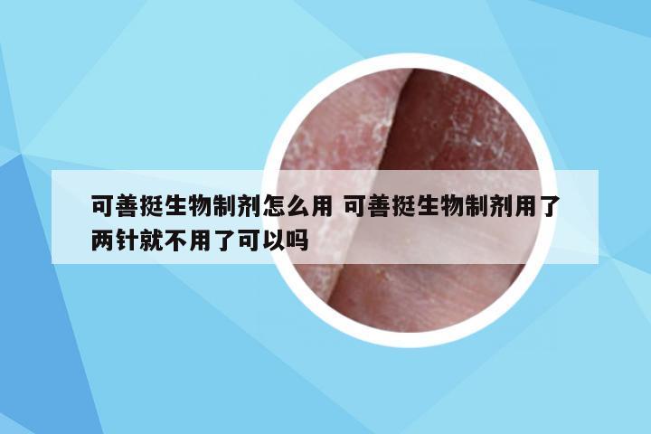 可善挺生物制剂怎么用 可善挺生物制剂用了两针就不用了可以吗