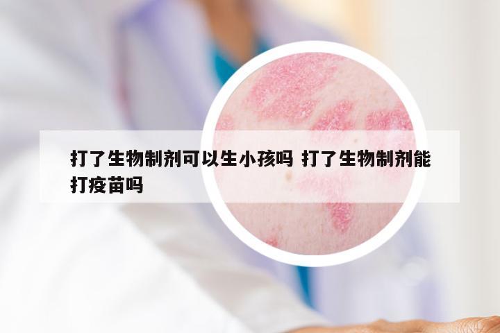 打了生物制剂可以生小孩吗 打了生物制剂能打疫苗吗