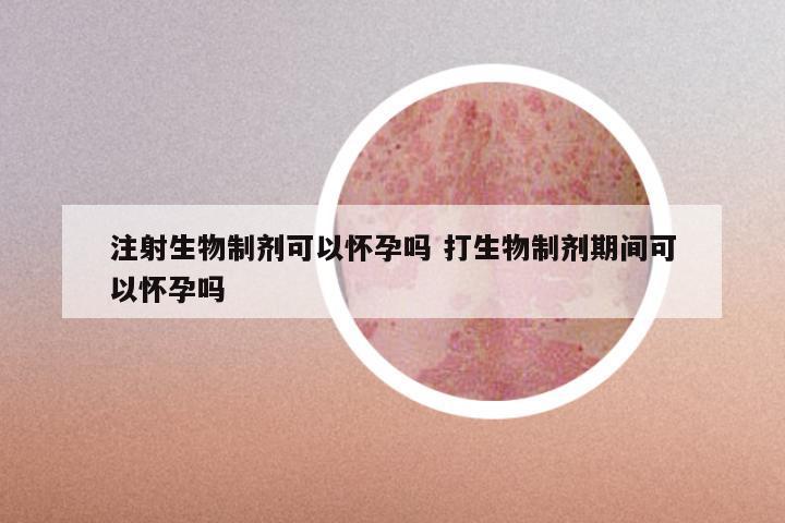 注射生物制剂可以怀孕吗 打生物制剂期间可以怀孕吗