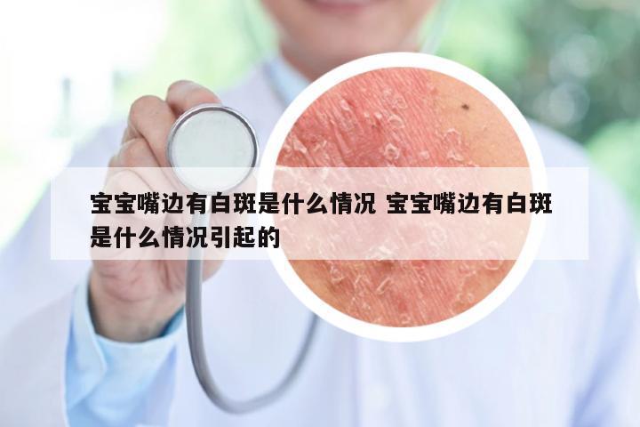 宝宝嘴边有白斑是什么情况 宝宝嘴边有白斑是什么情况引起的