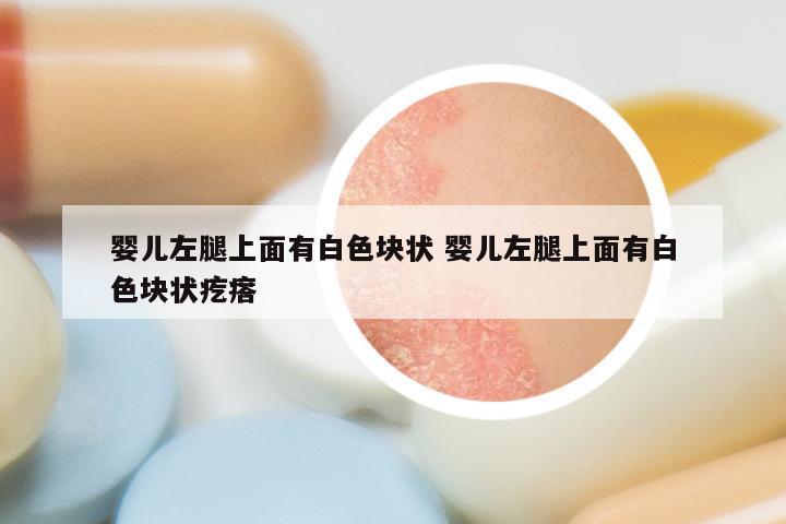 婴儿左腿上面有白色块状 婴儿左腿上面有白色块状疙瘩