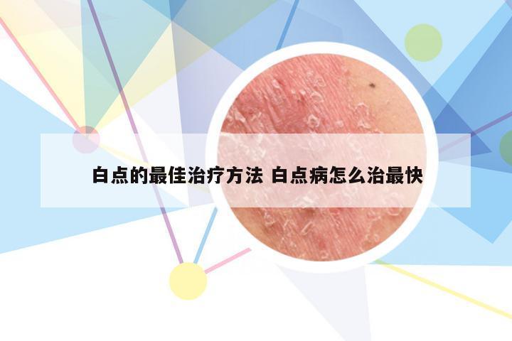 白点的最佳治疗方法 白点病怎么治最快