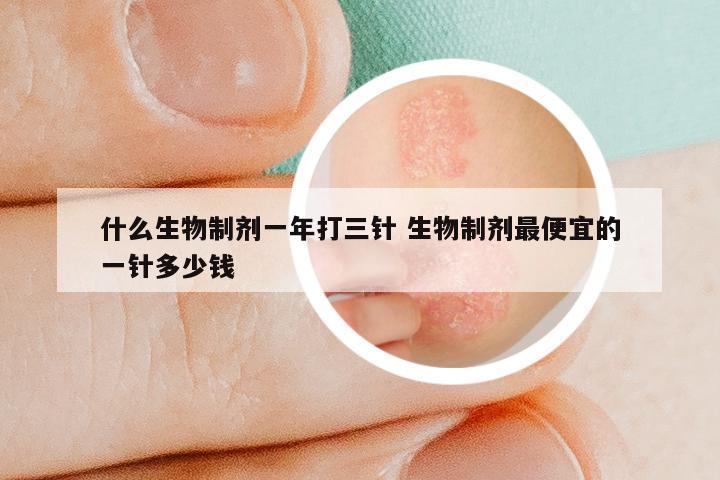 什么生物制剂一年打三针 生物制剂最便宜的一针多少钱