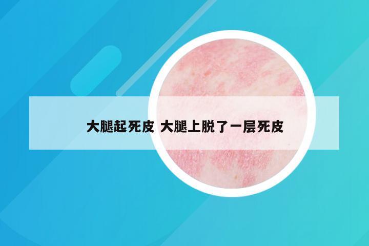 大腿起死皮 大腿上脱了一层死皮