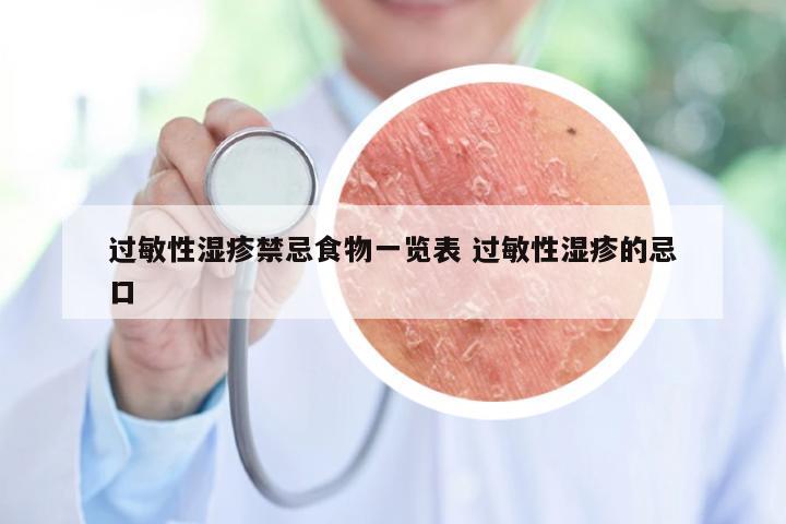 过敏性湿疹禁忌食物一览表 过敏性湿疹的忌口