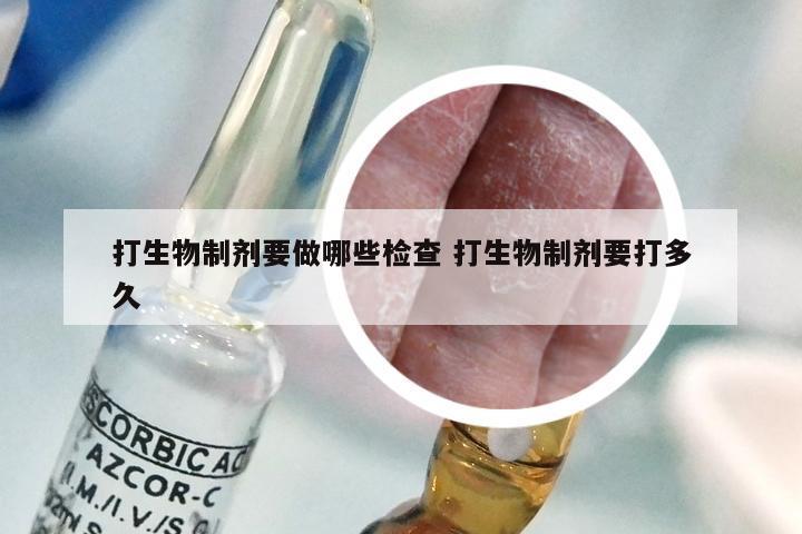 打生物制剂要做哪些检查 打生物制剂要打多久