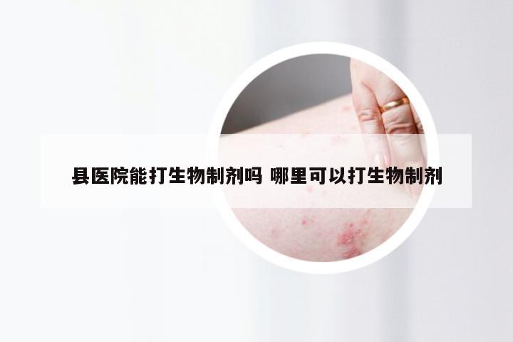 县医院能打生物制剂吗 哪里可以打生物制剂