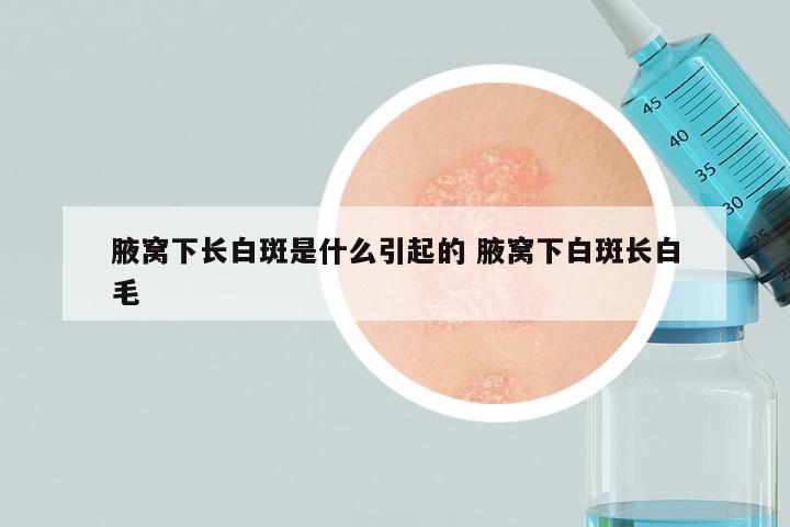 腋窝下长白斑是什么引起的 腋窝下白斑长白毛