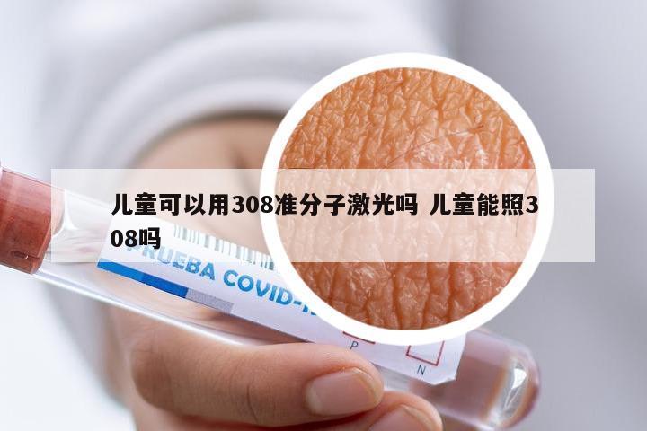 儿童可以用308准分子激光吗 儿童能照308吗