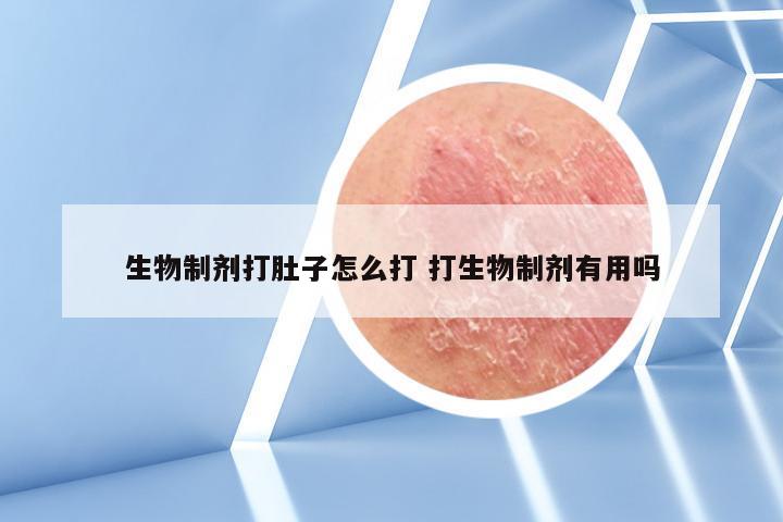 生物制剂打肚子怎么打 打生物制剂有用吗