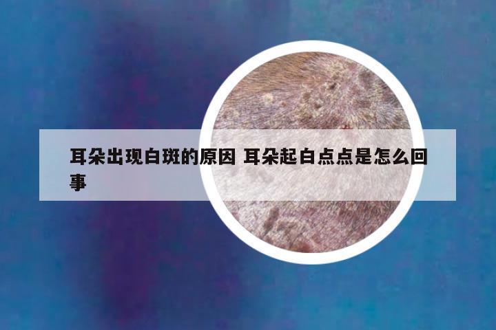 耳朵出现白斑的原因 耳朵起白点点是怎么回事