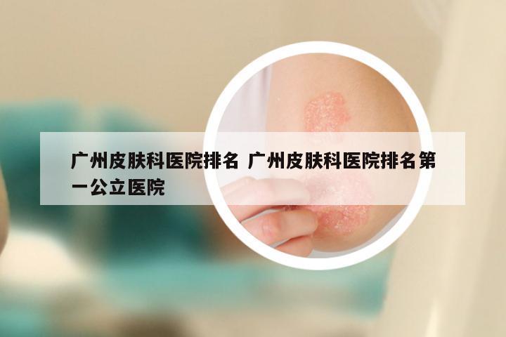 广州皮肤科医院排名 广州皮肤科医院排名第一公立医院