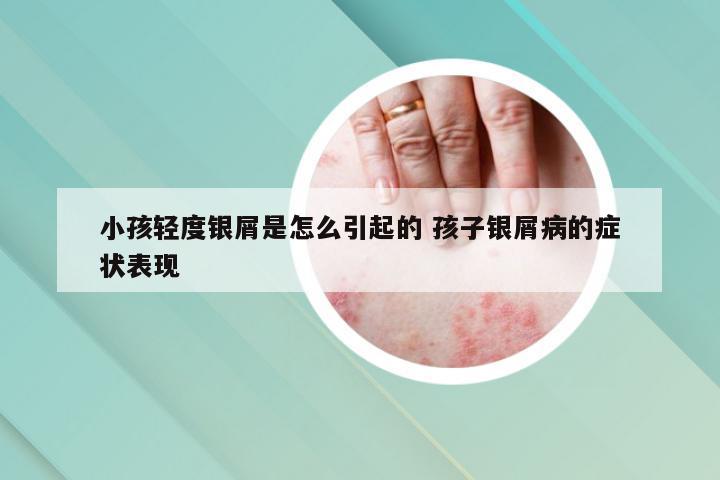 小孩轻度银屑是怎么引起的 孩子银屑病的症状表现