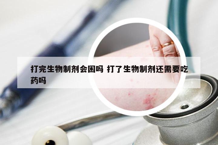 打完生物制剂会困吗 打了生物制剂还需要吃药吗