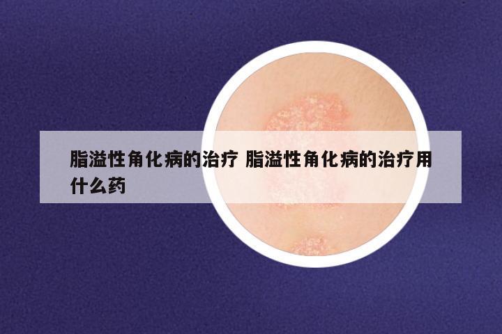 脂溢性角化病的治疗 脂溢性角化病的治疗用什么药