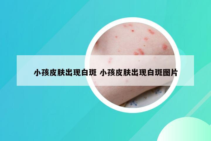 小孩皮肤出现白斑 小孩皮肤出现白斑图片