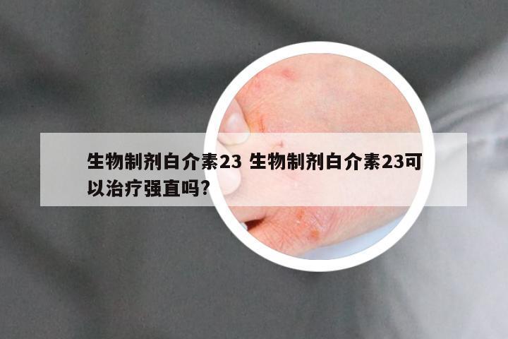 生物制剂白介素23 生物制剂白介素23可以治疗强直吗?