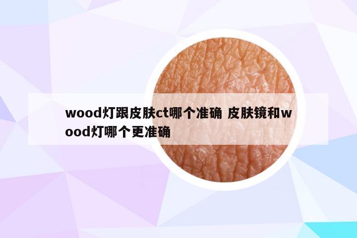 wood灯跟皮肤ct哪个准确 皮肤镜和wood灯哪个更准确