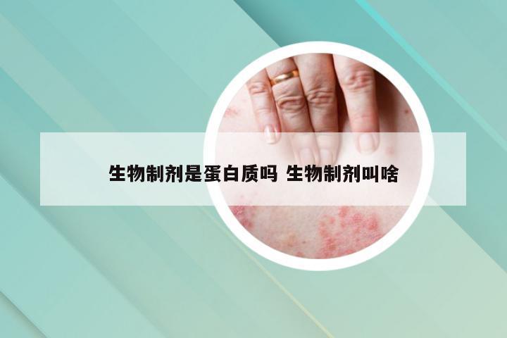 生物制剂是蛋白质吗 生物制剂叫啥