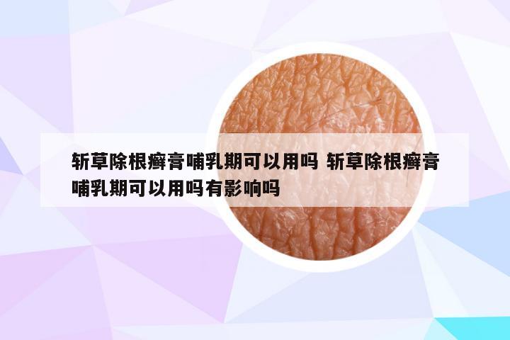 斩草除根癣膏哺乳期可以用吗 斩草除根癣膏哺乳期可以用吗有影响吗