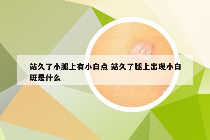 站久了小腿上有小白点 站久了腿上出现小白斑是什么