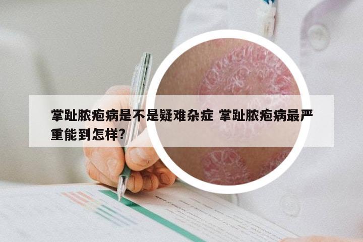 掌趾脓疱病是不是疑难杂症 掌趾脓疱病最严重能到怎样?