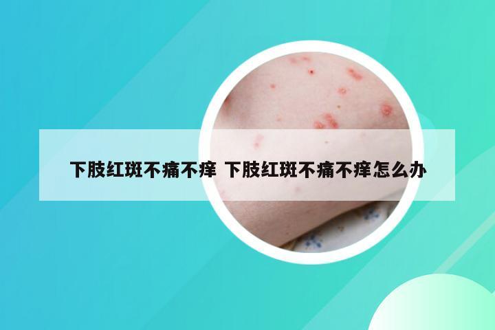 下肢红斑不痛不痒 下肢红斑不痛不痒怎么办