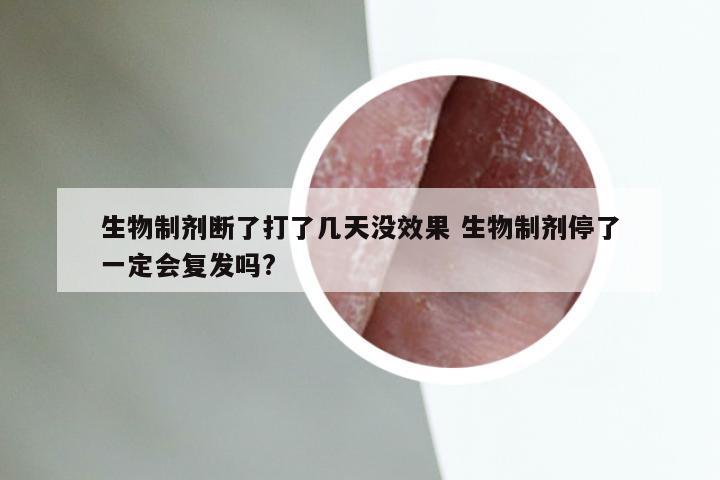 生物制剂断了打了几天没效果 生物制剂停了一定会复发吗?