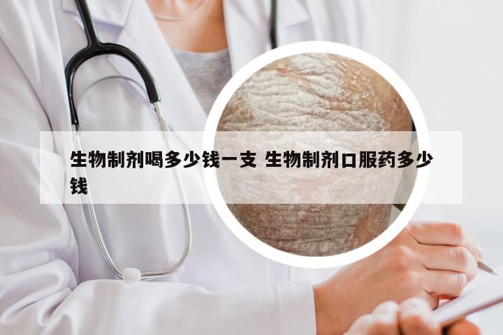 生物制剂喝多少钱一支 生物制剂口服药多少钱