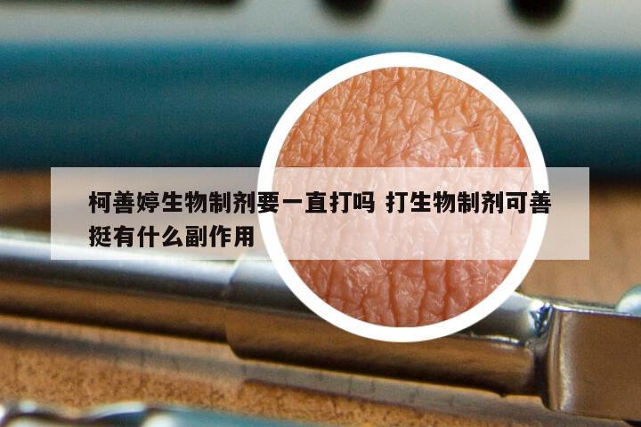 柯善婷生物制剂要一直打吗 打生物制剂可善挺有什么副作用