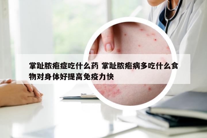 掌趾脓疱症吃什么药 掌趾脓疱病多吃什么食物对身体好提高免疫力快