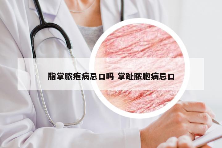 脂掌脓疱病忌口吗 掌趾脓胞病忌口