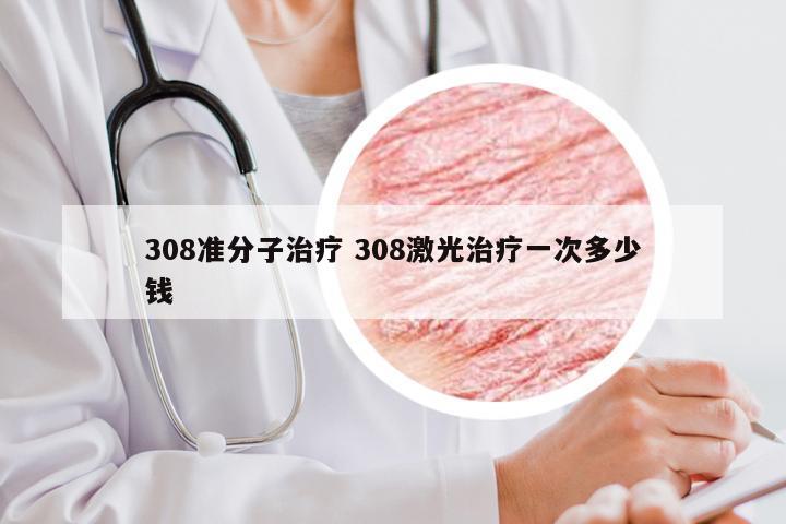 308准分子治疗 308激光治疗一次多少钱