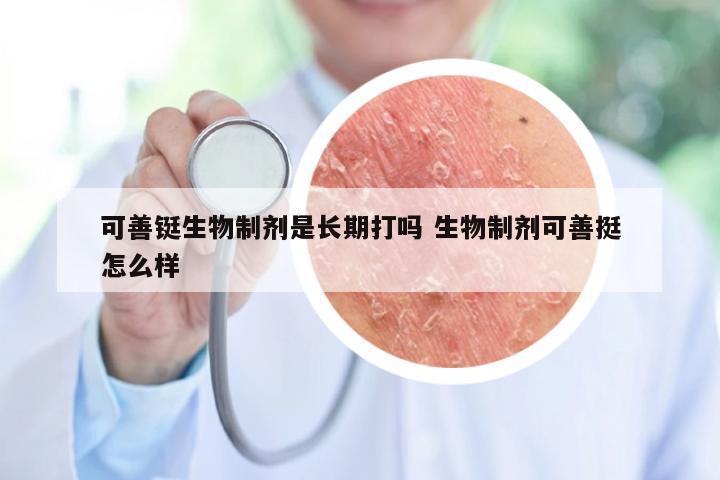 可善铤生物制剂是长期打吗 生物制剂可善挺怎么样