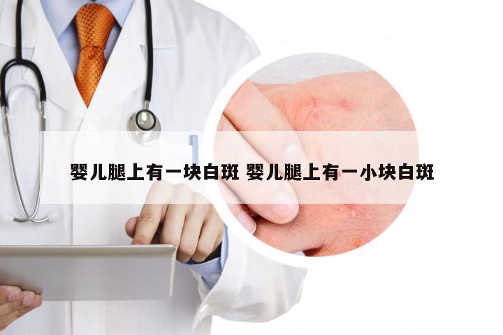 婴儿腿上有一块白斑 婴儿腿上有一小块白斑