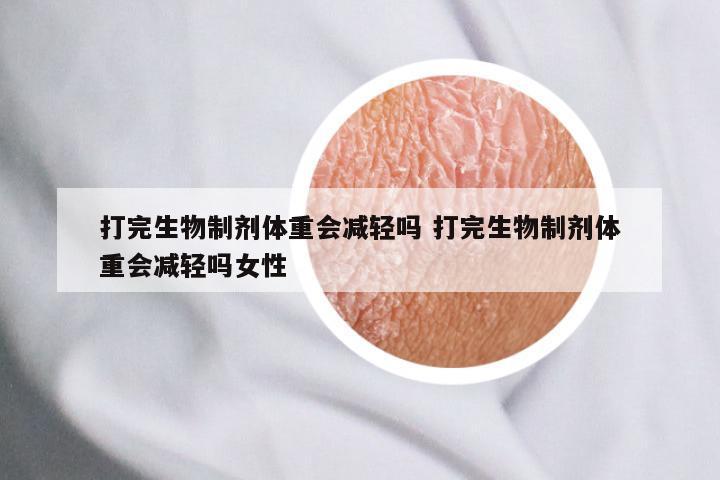 打完生物制剂体重会减轻吗 打完生物制剂体重会减轻吗女性