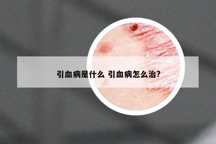 引血病是什么 引血病怎么治?