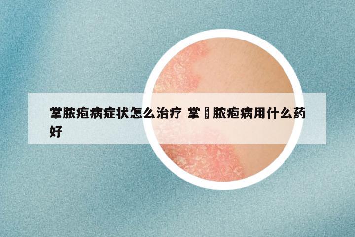 掌脓疱病症状怎么治疗 掌踀脓疱病用什么药好