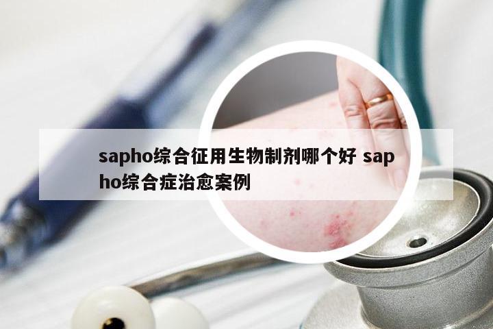 sapho综合征用生物制剂哪个好 sapho综合症治愈案例