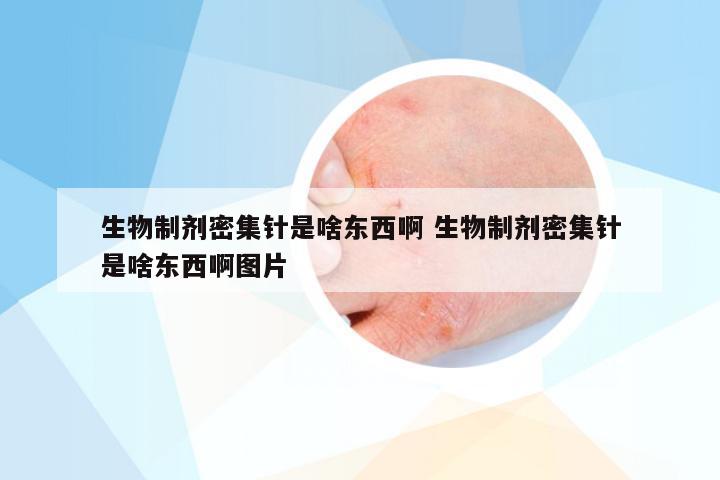 生物制剂密集针是啥东西啊 生物制剂密集针是啥东西啊图片