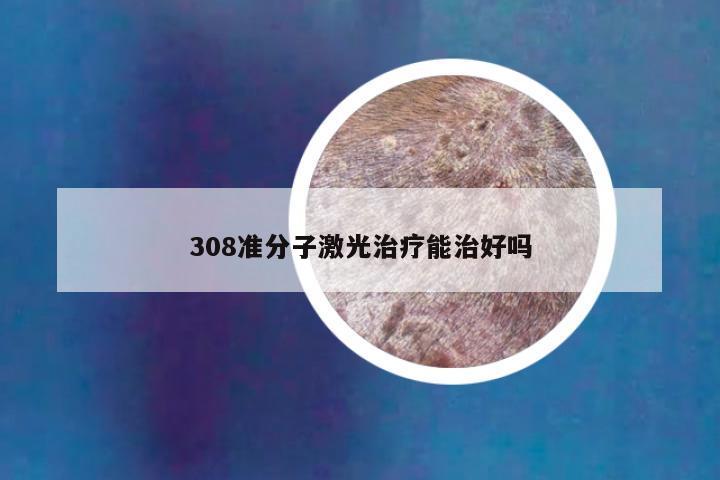 308准分子激光治疗能治好吗