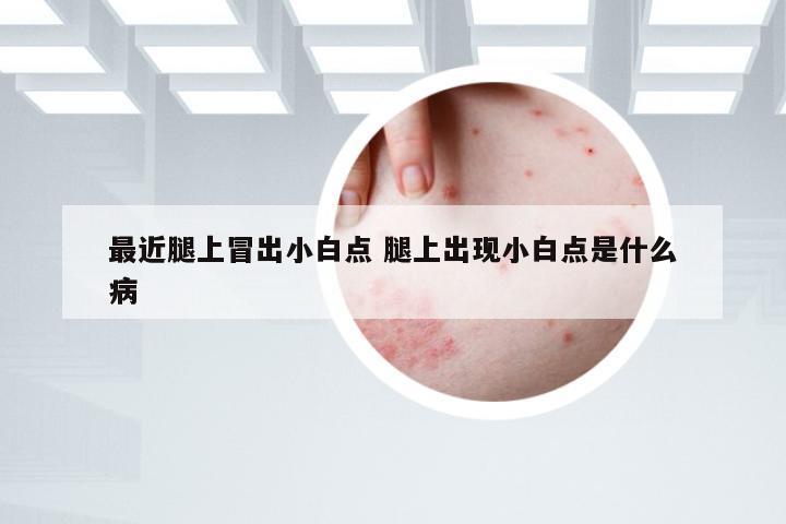 最近腿上冒出小白点 腿上出现小白点是什么病