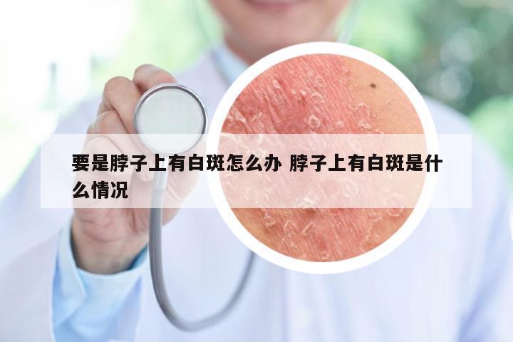 要是脖子上有白斑怎么办 脖子上有白斑是什么情况